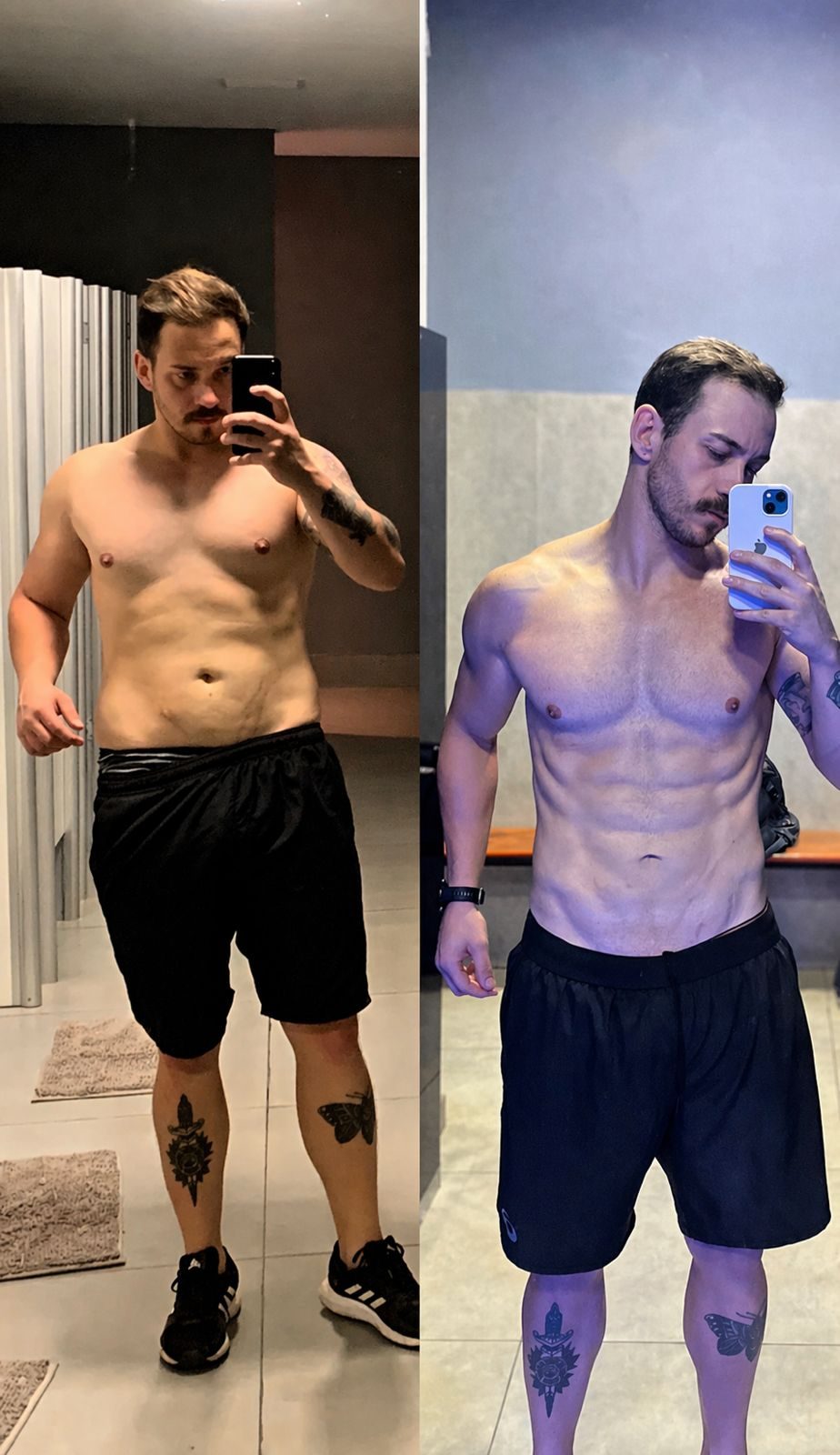Antes e depois caso 06